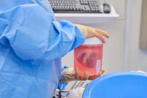Leyenda: Corazones de cerdo transgénicos suspendidos en solución antes del xenotrasplante en NYU Langone Health, miércoles 6 de julio de 2022.Crédito: Joe Carlotta, NYU Langone Health