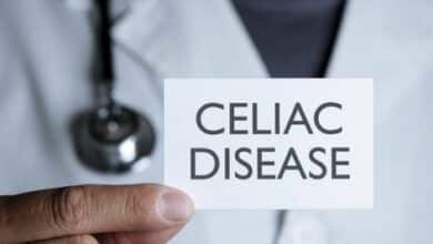 Vitamin deficiencies may be the only sign of celiac disease