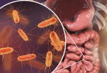 Diet, nutrition have profound effects on gut microbiome