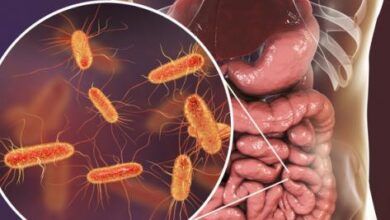 Diet, nutrition have profound effects on gut microbiome