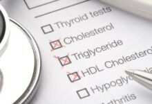 Men with high good cholesterol levels may live longer