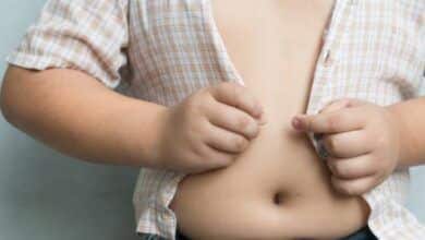 COVID-19 lockdowns worsen childhood obesity