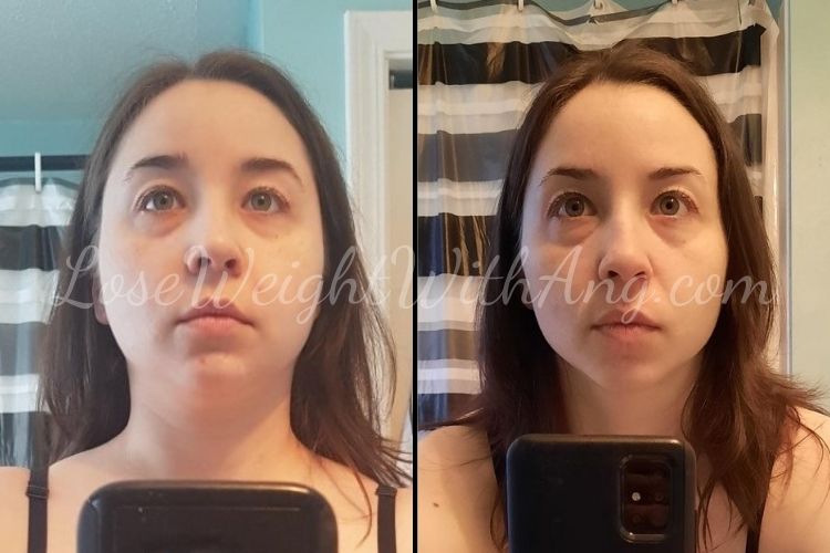 Fotos de antes y después de la pérdida de peso facial.  !72 libras hasta 120