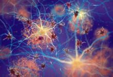 2CE12PN forma placas de amiloide entre las neuronas. Beta-amiloide interrumpe la función de las células nerviosas en los cerebros de la enfermedad de Alzheimer