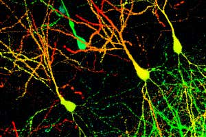 neuronas del cerebro del ratón