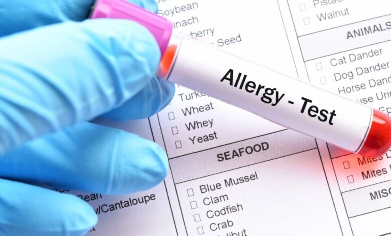 Como un dietista registrado puede ayudarlo con las alergias alimentarias