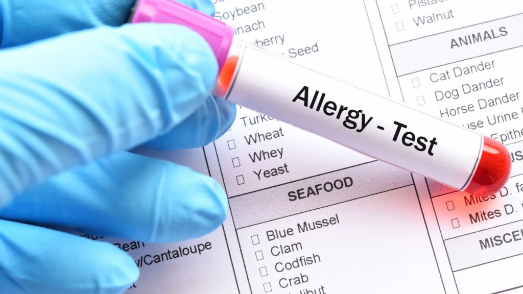 Como un dietista registrado puede ayudarlo con las alergias alimentarias