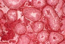 Micrografía óptica de una sección a través de los túbulos seminíferos (sitio de producción de esperma)