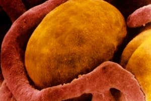Células de grasa marrón, capturadas por una micrografía electrónica de barrido en color, rodeadas de capilares.La activación de las grasas marrones a través de la exposición al frío puede hacer que quemen glucosa, de la que dependen las células cancerosas para crecer