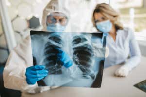 Nueve personas diagnosticadas con neumonía de origen desconocido en rayos X en la provincia de Tucumán, noroeste de Argentina