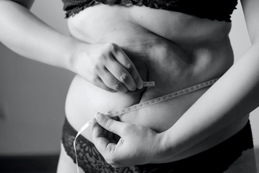 ¿Cómo se ve el vientre del síndrome de ovario poliquístico?