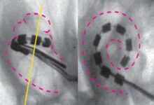 Radiografías multiángulo que muestran implantes cocleares en una rata
