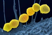bacterias estreptococos del grupo A