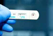 Prueba del VIH aparato
