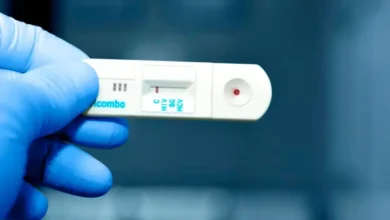 Prueba del VIH aparato